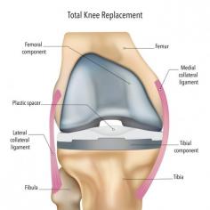 Expert Care for Your Knee Replacement in Melbourne

Get back to doing what you love with reliable and advanced knee replacement solutions in Melbourne. Mr Vishal Pai is dedicated to providing tailored care, using modern techniques to ensure the best outcomes. Here’s why we stand out:

  

Extensive training and experience in robotic-assisted knee replacement. 
Tailored treatment plans focused on your unique needs and recovery goals. 
Utilises the latest technology for accurate surgeries and improved recovery. 
Numerous successful surgeries with patients regaining mobility and comfort. 