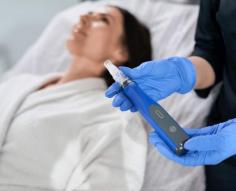 At Cosmedica Australia, we specialise in delivering advanced skincare solutions that restore confidence and enhance natural beauty. Based in Bellevue Hill, we offer microneedling services across Sydney to help clients achieve smoother, firmer, and more youthful skin. Our expert nurses, with over 40 years of combined experience, provide safe and effective treatments tailored to individual skin concerns.