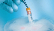 The IUI Process in Melbourne Made Simple and Stress-Free
When you are ready to grow your family, the insemination process in Melbourne should feel supported, not overwhelming. Dr Daniel Lantsberg is a trusted fertility specialist offering expert IUI treatment designed around your individual needs. The IUI process in Melbourne involves placing carefully prepared sperm directly into the uterus at the optimal point in your cycle, giving conception the best possible chance without invasive procedures.
Minimally uncomfortable procedure with no anaesthesia or downtime required
Monitored cycles using ultrasound and hormone testing for precise timing
Suitable for single women, same-sex couples, and cases of unexplained infertility
Sperm washing process used to ensure only the healthiest, most motile sperm are selected
Natural and stimulated cycle options available based on your circumstances
Compassionate, inclusive care for all family structures
Take the next step toward parenthood. Book a consultation with Dr Daniel Lantsberg today.