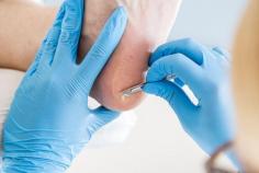 Comprehensive Foot Clinic in Beaumaris Providing Professional Podiatry Care
We are a trusted foot clinic in Beaumaris offering professional assessment and treatment for a wide range of foot and lower limb concerns. Our personalised care plans help improve comfort, mobility, and overall foot health for patients of all ages.