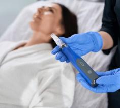 Microneedling, performed using the industry-leading SkinPen, creates micro-channels in the skin, triggering collagen and elastin production. This natural healing response reduces acne scars, wrinkles, and uneven texture, leaving the skin refreshed and revitalised. Our team prioritises precision and safety, continuously updating our expertise through ongoing cosmetic nursing and dermal therapy training.