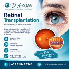 Retinal Transplantation is an advanced area of eye care focused on restoring or improving vision in patients with severe retinal damage or degenerative retinal conditions. This specialized procedure involves replacing or repairing damaged retinal tissue using advanced medical techniques aimed at supporting retinal function and preserving vision. Performed by experienced retinal specialists, retinal transplantation requires comprehensive evaluation, precise diagnosis, and personalized treatment planning. Choose a trusted ophthalmologist for expert retinal care, advanced treatment options, and dedicated support throughout your vision restoration journey.
