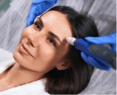 Since 2019, our professional skin-needling services in Sydney have been dedicated to helping clients achieve smoother, more radiant skin. We specialise in treating various skin concerns, including acne scars, surgical scars, and fine lines. Our experienced practitioners tailor each session to meet your unique skin needs, ensuring personalised care that delivers visible results and enhances your complexion. In addition to addressing scars, our skin needling treatments effectively target hyperpigmentation and wrinkles, promoting an even skin tone and texture.